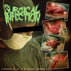 Surgical Infection : Confession of a Surgical Madman